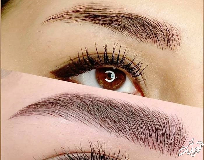 ماندگاری فیبروز ابرو ماندگاری فیبروز